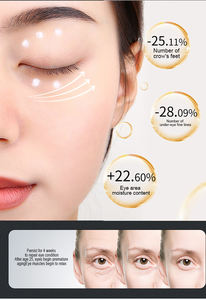 Masseur oculaire magnétique chauffant portable pour éliminer les cernes, meilleur prix, respectueux de l'environnement - Product Image 2