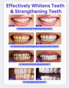 Strisce Sbiancanti Dentali Personalizzate, Rapide e Indolori, Sicure per lo Smalto, Lunga Durata, Strisce Sbiancanti a Dissoluzione Rapida - Product Image 6