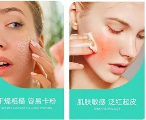 Wholesale Customized Humanized Type III Collagen Face Body Mask Dry Oily Skin Repair Patch Dressings Cotton Sheet Masks Sample