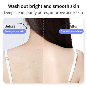 Gel douche moussant exfoliant éclaircissant pour la peau en marque propre, hydratant, nettoyage en profondeur, vitamine C, acide aminé pour bébé - Product Image 2