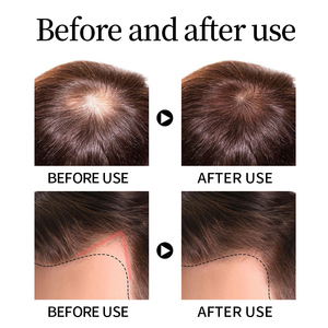 Großhandel 200ml Rosmarin-Haaröl Haarstärkung Haarpflege Rosmarinöl Regelmäßige Anwendung Reines Rosmarin-Haaröl - Product Image 5