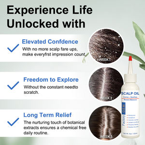 Huile de <span class=keywords><strong>psoriasis</strong></span> et de pellicules de marque privée pour le cuir chevelu huile de massage apaisante squameuse anti-démangeaisons pour le cuir chevelu - Product Image 5