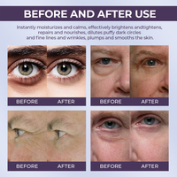 Sérum Crème Contour des Yeux Coréen Végétalien Personnalisé Anti-Poches Anti-Âge Éclaircissant à la Caféine pour Massage et Réparation des Sacs sous les Yeux