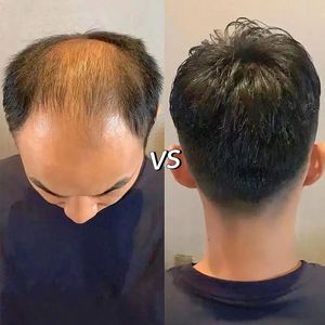 Prothèse capillaire <span class=keywords><strong>DMC</strong></span> durable en cheveux humains fins, toupet pour hommes, unités capillaires économiques, systèmes capillaires pour hommes avec revêtement en polyuréthane - Product Image 5
