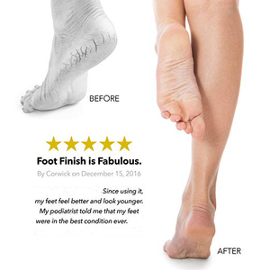 Meilleur dissolvant de <span class=keywords><strong>callosités</strong></span> crème <span class=keywords><strong>Anti</strong></span>-fissure pour les pieds urée crème hydratante pour les peaux mortes et sèches - Product Image 6