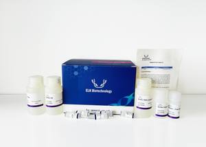 Kit de Preparación de Plásmidos de Alta Calidad, Gran Venta para Investigación - Product Image 6