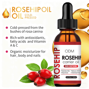 Dầu hoa hồng Tinh dầu chăm sóc da cơ sở dầu dựa trên hạt duy trì sự ổn định sửa chữa mờ dần mụn trứng cá toàn bộ dầu cơ thể - Product Image 6