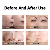 JMFREE Vente en gros Format voyage Soin de la peau à décoller Masque réparateur en poudre Masque à la gelée de cacao Tasse de masque