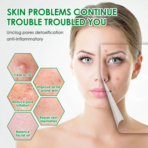 Siero Anti-Acne all'Acido Salicilico a Prezzo di Fabbrica, Fiala per Restringere i Pori, Affinare, Illuminare e Rassodare la Pelle, Siero Sbiancante per il <span class=keywords><strong>Viso</strong></span> - Product Image 6