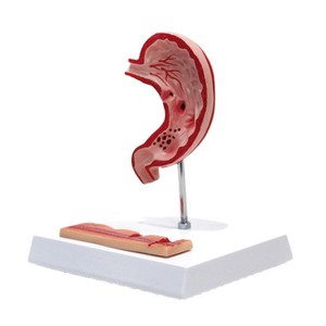 Modelo anatómico del estómago humano; modelo de demostración para la enseñanza y formación en facultades de medicina y popularización de la ciencia. - Product Image 5
