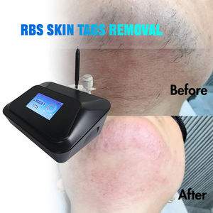 Appareil d'épilation à l'aiguille isolée à froid 2 en 1, <span class=keywords><strong>électrolyse</strong></span>, épilation du <span class=keywords><strong>visage</strong></span>, machine d'épilation pour salon - Product Image 2