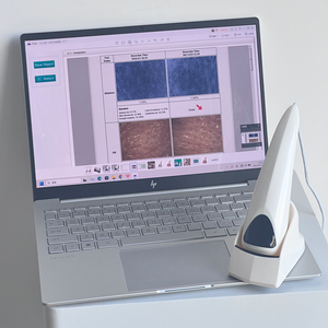 Analizador Digital de Piel con 8 Reportes, Escáner de Pigmentación de Poros, Máquina de Análisis de Piel - Product Image 3