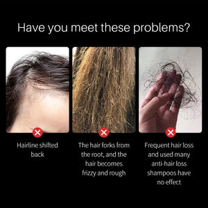 Aceite para el Crecimiento del Cabello Natural de Romero y Batana, Nutritivo, Sin Silicona, 30 ml, Apto para Todo Tipo de Cabello - Product Image 2