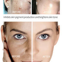 Crème Éclaircissante Intensive au Glutathion et aux Herbes 20g – Vitamine C, Acide Kojique, Antioxydant, Glycérine pour un Teint Lumineux et Durable