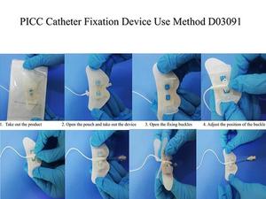 Pemegang kateter vena Pusat sekali pakai Medis 3cm x 9cm untuk perangkat perbaikan kateter fiksasi dan keamanan PIC/<span class=keywords><strong>CVC</strong></span> - Product Image 3