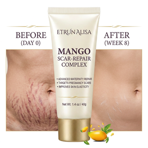 Crème ETRUN ALISA à marque privée, à la mangue, à l'<span class=keywords><strong>aloe</strong></span> <span class=keywords><strong>vera</strong></span> <span class=keywords><strong>et</strong></span> à la vitamine E, pour l'élimination des <span class=keywords><strong>vergetures</strong></span>, des cicatrices <span class=keywords><strong>et</strong></span> des brûlures, <span class=keywords><strong>et</strong></span> la réparation des <span class=keywords><strong>anciennes</strong></span> cicatrices. - Product Image 4