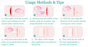 เทปกาวทางการแพทย์เย็บปราศจากเชื้อแบบใช้แล้วทิ้งเทปที่ปราศจากเชื้อมีความยืดหยุ่นดี - Product Image 5
