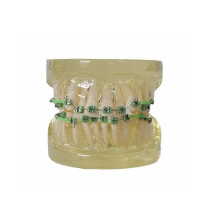 Modèle de dents dentaires/modèle orthodontique <span class=keywords><strong>dentaire</strong></span> avec supports métalliques - Product Image 2