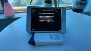 Mesin <span class=keywords><strong>Ultrasound</strong></span> Linear Nirkabel 128 Elemen Warna, Mesin <span class=keywords><strong>Ultrasound</strong></span> Vaskular Linear Portabel - Product Image 3