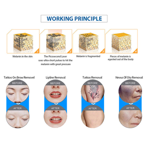 Máy Xóa Hình Xăm Laser Picosecond Nd Yag Chuyển Mạch Q Picosecond Di Động Laser Pico Xóa Nếp Nhăn Làm Trắng Da - Product Image 4