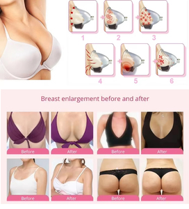 Instrument de Massage du sein sein agrandir Drainage lymphatique bout à bout grattage Massage du dos sein agrandir Machine de beauté - Product Image 5