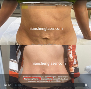 Niansheng NS-M16 Envío Gratis, Máquina de Cuidado Personal 2 en 1 de Material ABS, Endo Lift para Rostro y Cuerpo, 3m de Largo - Product Image 6