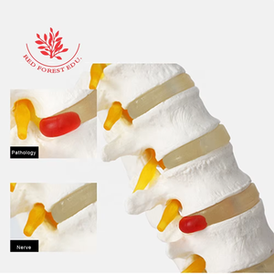 Ukuran hidup Model vertebra 5 buah dengan kiropraktik akar syaraf, kantor osteoath dan studi siswa - Product Image 6