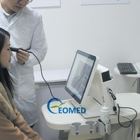 Ecógrafo Oftálmico Óptico EOMED de la Mejor Calidad, Escaneo AB/B, Computadora Integrada, EUS500, 1 Año de Garantía