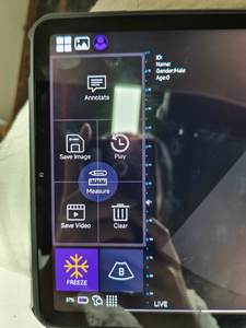 BMV BestScan S7 Plus Scanner portable à ultrasons vétérinaire de type C pour ultrasons de <span class=keywords><strong>test</strong></span> de grossesse de bétail/mouton/chèvre/cheval - Product Image 6