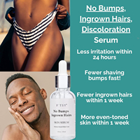 Sérum anti-poils incarnés et boutons de rasage à marque privée – Élimine les boutons de rasage, les brûlures de rasoir et les taches sombres