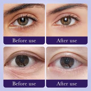 Mascarillas de Hidrogel para el Cuidado de los <span class=keywords><strong>Ojos</strong></span> SADOER, Parches de Gel Antienvejecimiento con Colágeno y Semillas de Uva para Debajo de los <span class=keywords><strong>Ojos</strong></span>, Venta al Por Mayor - Product Image 6
