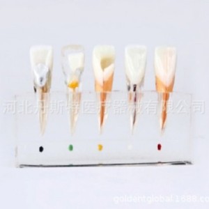 Modèle d'enseignement dentaire Dt M4008, modèle anatomique en silicone médical pour traitement endodontique, destiné à l'enseignement des sciences médicales - Product Image 1