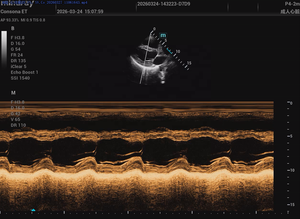 Appareil d'échographie Mindray de dernière génération, haute performance et économique, Mindray Consona ET avec double écran pour hôpital - Product Image 5
