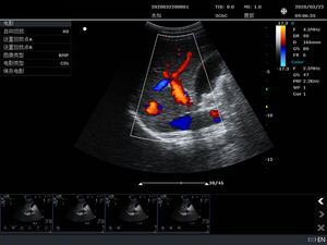 Máquina de Ultrassom Doppler Colorido C10B Dispositivo Portátil - Product Image 6