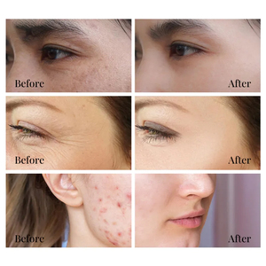 Tùy Chỉnh <span class=keywords><strong>C</strong></span>ông Thứ<span class=keywords><strong>c</strong></span> Chăm Só<span class=keywords><strong>c</strong></span> Da Mặt Huyết Thanh Collagen Axit Hyaluronic Niacinamide Retinol Vitamin <span class=keywords><strong>C</strong></span> Mặt Huyết Thanh - Product Image 4