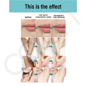 Sérum anti-poils, inhibiteur de croissance des poils, produit naturel, pour les aisselles, la <span class=keywords><strong>barbe</strong></span> et les jambes, g - Product Image 4