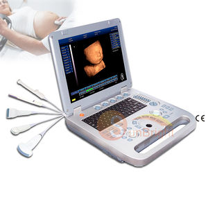 Ecógrafo 3D basado en PC con impresora láser, impresora térmica portátil - Product Image 1