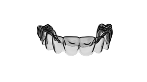 Shinye fabbrica all'ingrosso ortodontico dentale chiaro alligner foglio per l'allineamento dei denti trasparente ortodontico allineamento dentale - Product Image 3