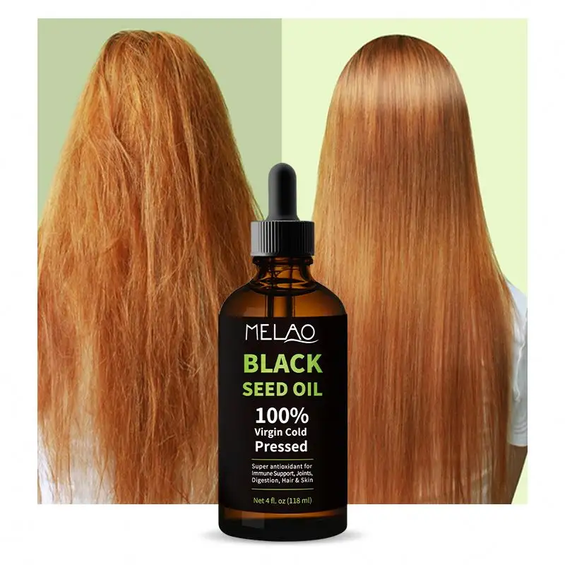 Aceite De Semilla Negra prensado en frío sin diluir para el cuidado facial suavizante puro orgánico 100% para el cabello y la piel