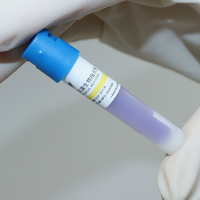 Indicateur biologique autoclavable jetable à vente rapide, test rapide et standard 24h en tube pour usage en CSSD et hôpitaux