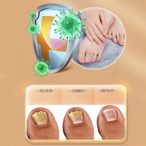 Solución OEM para el Tratamiento de Onicomicosis, Cuidado Antibacteriano de Uñas para Manos y Pies, Reparación de Daños, Especificaciones Normales - Product Image 1