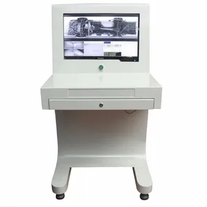 Cố Định UVIS Dưới Giám Sát Xe Kiểm Tra Hệ Thống Camera An Ninh Xe - Product Image 4