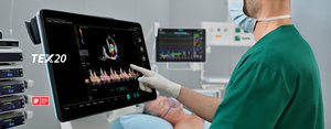 Ecógrafo Doppler Color 2D 3D 4D Mindray TEX20, Máquina de Ecografía Cardiovascular para Veterinaria y Uso Humano - Product Image 4