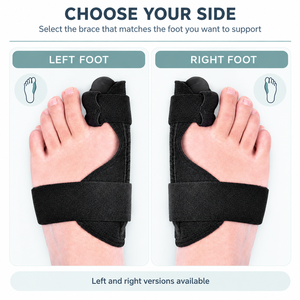Penyangga Jari Kaki Besar untuk Pria Wanita, Penyangga Hallux Valgus untuk Meluruskan Jari Kaki Besar, Pereda Nyeri Kaki Siang Malam - Product Image 2