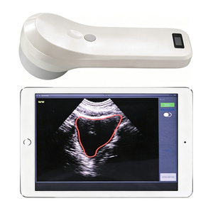 Escáner Inalámbrico de Vejiga 4D BProbe-2 para Diagnóstico por Ultrasonido en Cardiología, Gastroenterología, Urología y Riñón - Product Image 1