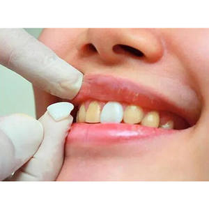 SowSmile-cubierta de reparación para dentaduras, accesorio temporal y Real instantáneo perfecto para el cuidado bucal Dental, con broche de sonrisa, dentaduras postizas - Product Image 4