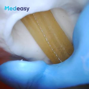 Entrenador de simulación de rodilla para artroscopia, simulador artroscópico de rodilla con artroscopio y sonda de 30 grados - Product Image 6