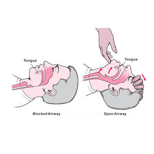 الإسعافات الأولية التدريس استخدام رئيس القسم القزم ل CPR التدريب عارضة أزياء مما يدل على التغييرات مجرى الهواء عن طريق الفم - Product Image 6