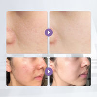 Masque Tissu Professionnel Acide Hyaluronique et Collagène pour Clinique Médico-Esthétique, Qualité Médicale Hydratation Profonde et Réparation