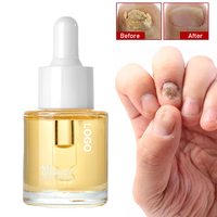 Huile de cuticule végétalienne biologique adoucissant et protecteur des ongles hydratant de marque privée pour la réparation des ongles